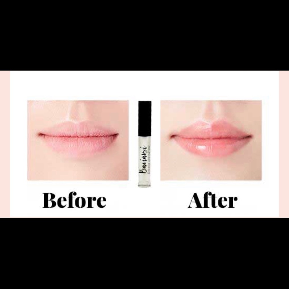 Plump your lips to perfection. Voluminous,sexy,soft,supple, &kissable. No sting.